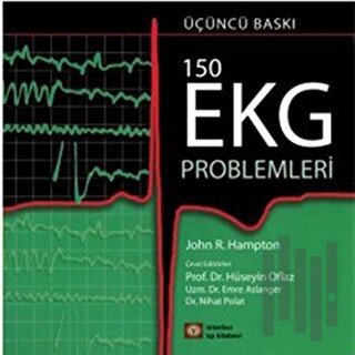150 EKG Problemleri