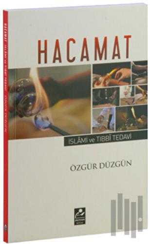 Hacamat - İslami ve Tıbbi Tedavi