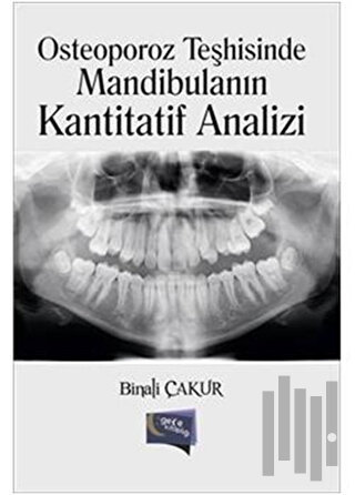 Osteoporoz Teşhisinde Mandibulanın Kantitatif Analizi