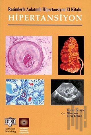 Resimlerle Anlatımlı Hipertansiyon El Kitabı